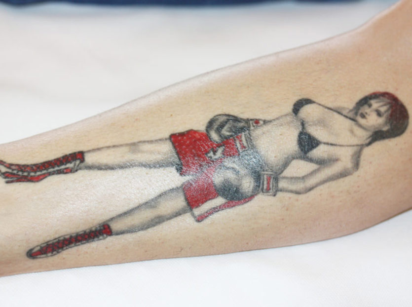 Tattooentfernung Behandlungsfotos Boxerin Originalzustand