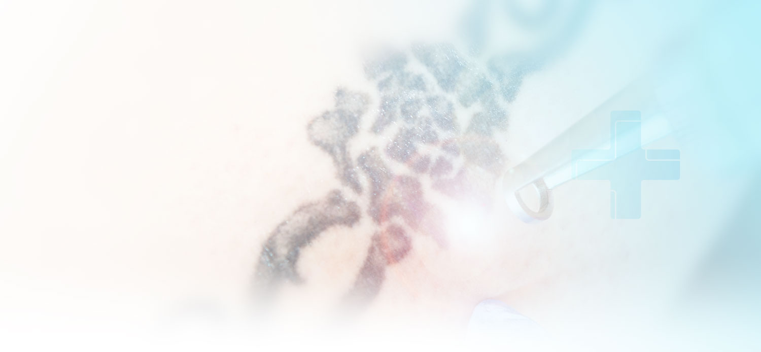 Bannerfoto Vorher Nachher
